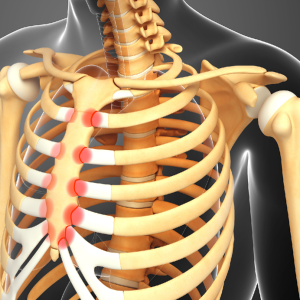 osteorijswijk-Jeroen-van-Leeuwen-osteopaat-osteopathie-hoofdpijn-spanningshoofdpijn-Clusterhoofdpijn-Migraine-Kaakklachten-Sinusitis-Duizeligheid-nekpijn-nekklachten-TOS-TOCS-Thoracic Outlet Syndroom-Erin geschoten-Zonder oorzaak-ermee opgestaan-Op de tocht gezeten-Whiplash-Restklachten na operatie-nekhernia-rugpijn-rugklachten-Door de rug gegaan-Vastzittend gevoel-Hernia achtige klachten-ischias-uitstralingssensaties-hernia-bekkenklachten-bekkenpijn-Scheefstand-Bekkeninstabiliteit-Verzakkingen-heuppijn-heupklachten-Liespijn-restklachten na een plaatsing van een kunstheup / heupprothese-kniepijn-knieklachten-Restklachten na plaatsing van een nieuwe knie / knieprothese-Restklachten na een meniscusoperatie-Restklachten na een voorste kruisband vervanging-enkelpijn-enkelklachten-voetpijn-voetklachten-Hielspoor-schouderpijn-schouderklachten-Ontstekingen-slijmbeursontsteking-peesontsteking-Frozen shoulder-Restklachten na een totale schouder vervanging / schouderprothese-elleboogpijn-elleboogklachten-Tenniselleboog-Golfersarm-Cubitaal tunnel syndroom-polspijn-polsklachten-handklachten-handpijn-Carpaal tunnelsyndroom-Quervain-Dupuytren-Restklachten na een operatie-sportblessures-buikpijn-buikklachten-Buikkrampen-Prikkelbaar Darm Syndroom-PDS-IBS-Verstopping-Diarree-Plasproblematiek-plasproblemen-Opgeblazen buik-Problemen met de stoelgang-buikoperatie-blindedarmontsteking-borstpijn-borstklachten-Pijn in de borststreek-Ademhalingsproblematiek-Syndroom van Tietze-Rijswijk-Den Haag-de Lier-Wateringen-Westland-Voorburg-Leidschendam-Den Hoorn-Delft-Naaldwijk-Monster-Hoek van Holland-Gravenzande-de beste osteopaat